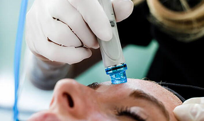 HydraFacial Treatment