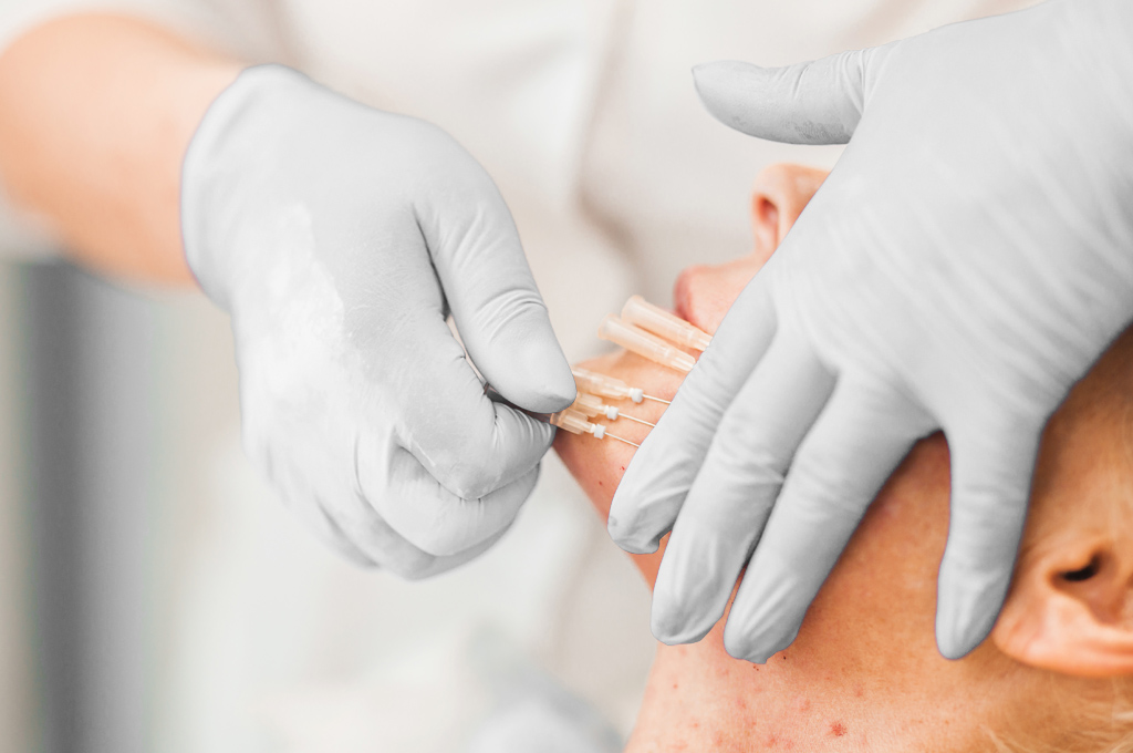 A dermapure physician treating a patient