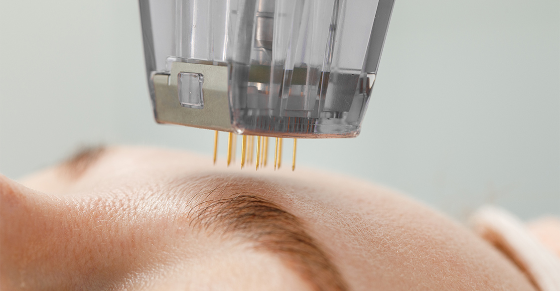 A dermapure physician treating a patient