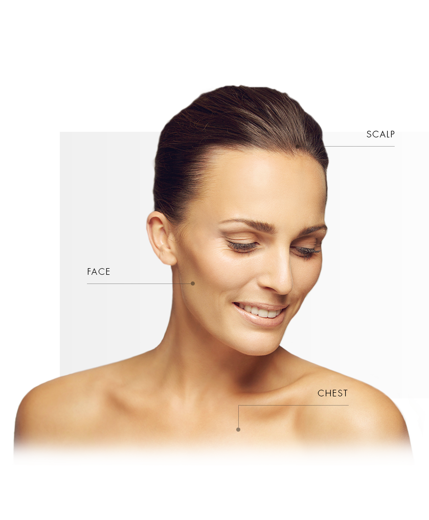 PDT_Femme_zones_traites1-EN