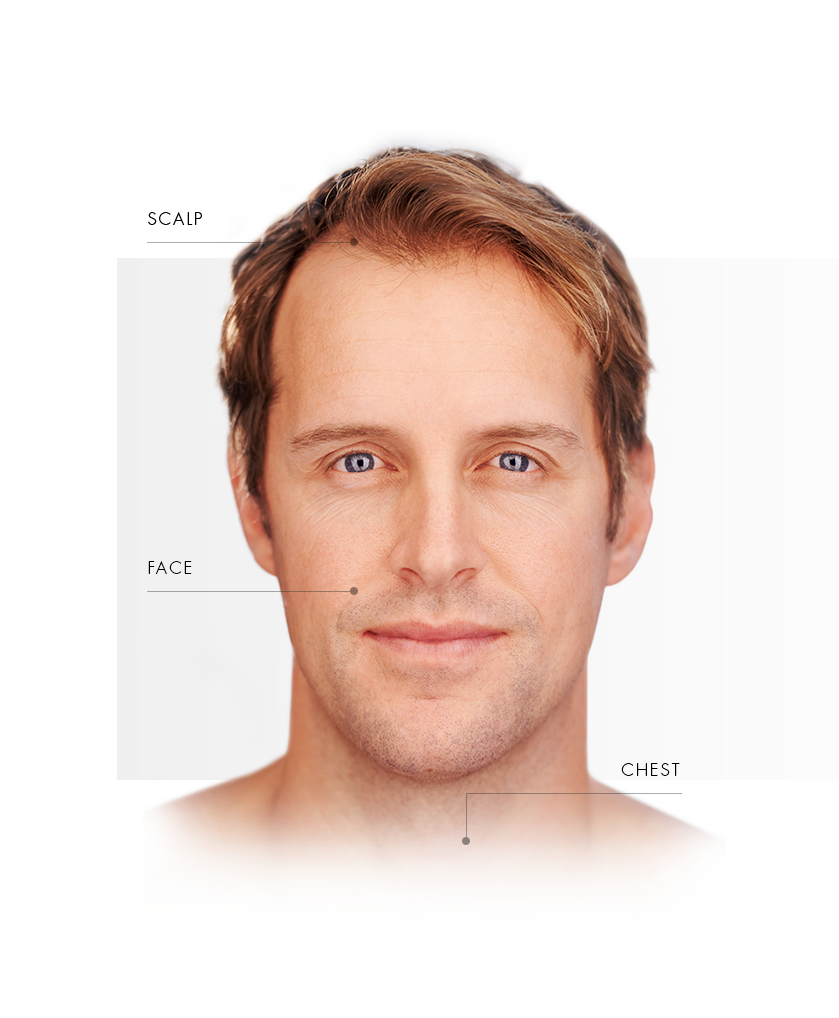 PDT_Homme_zones_traites1-EN
