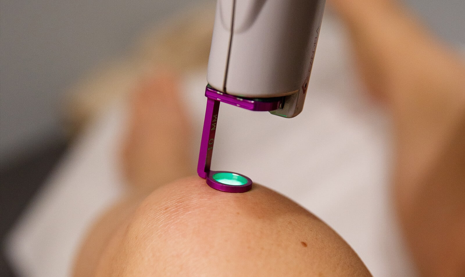 A photo of a dermapure clinic procedure room