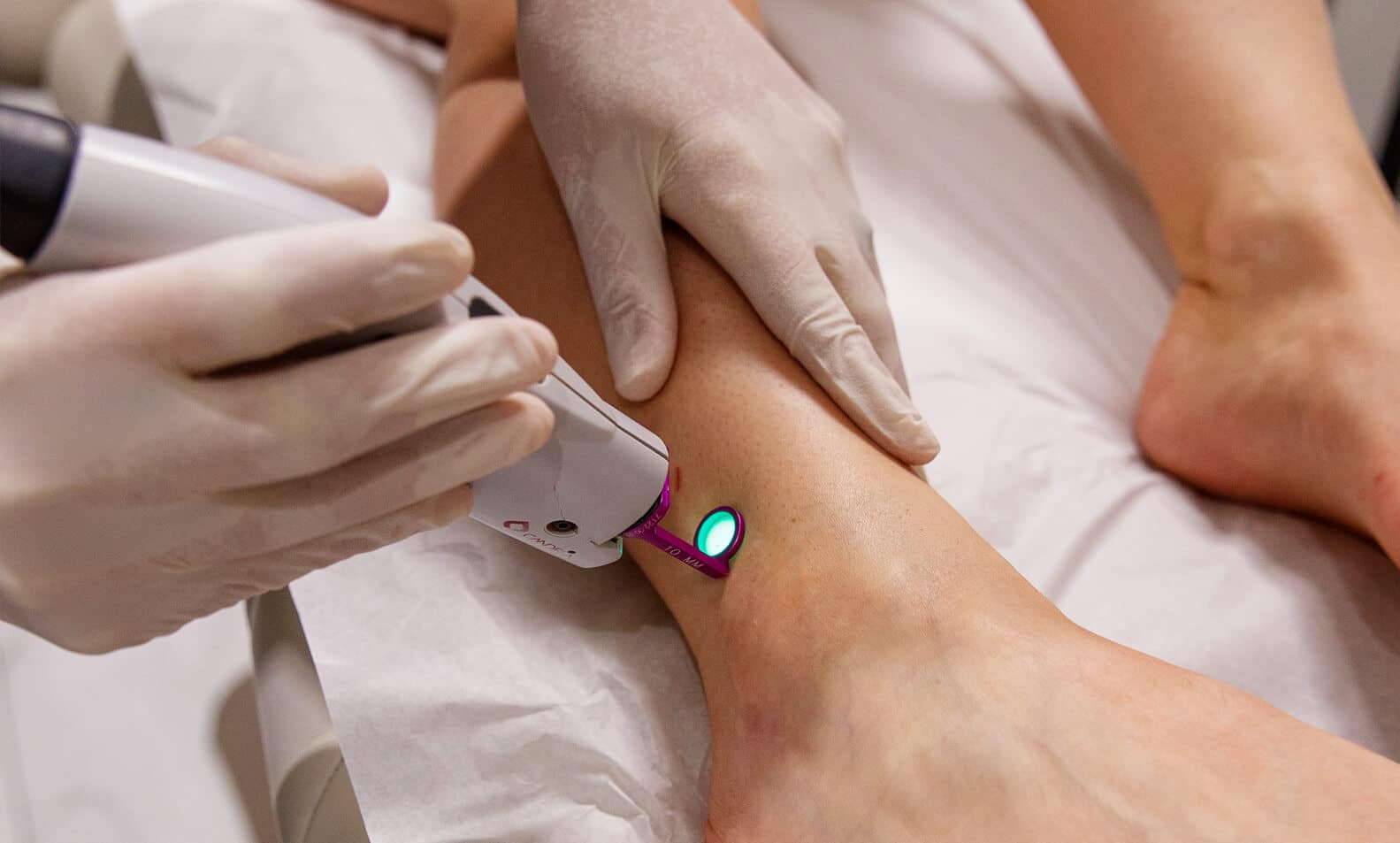 A dermapure physician treating a patient