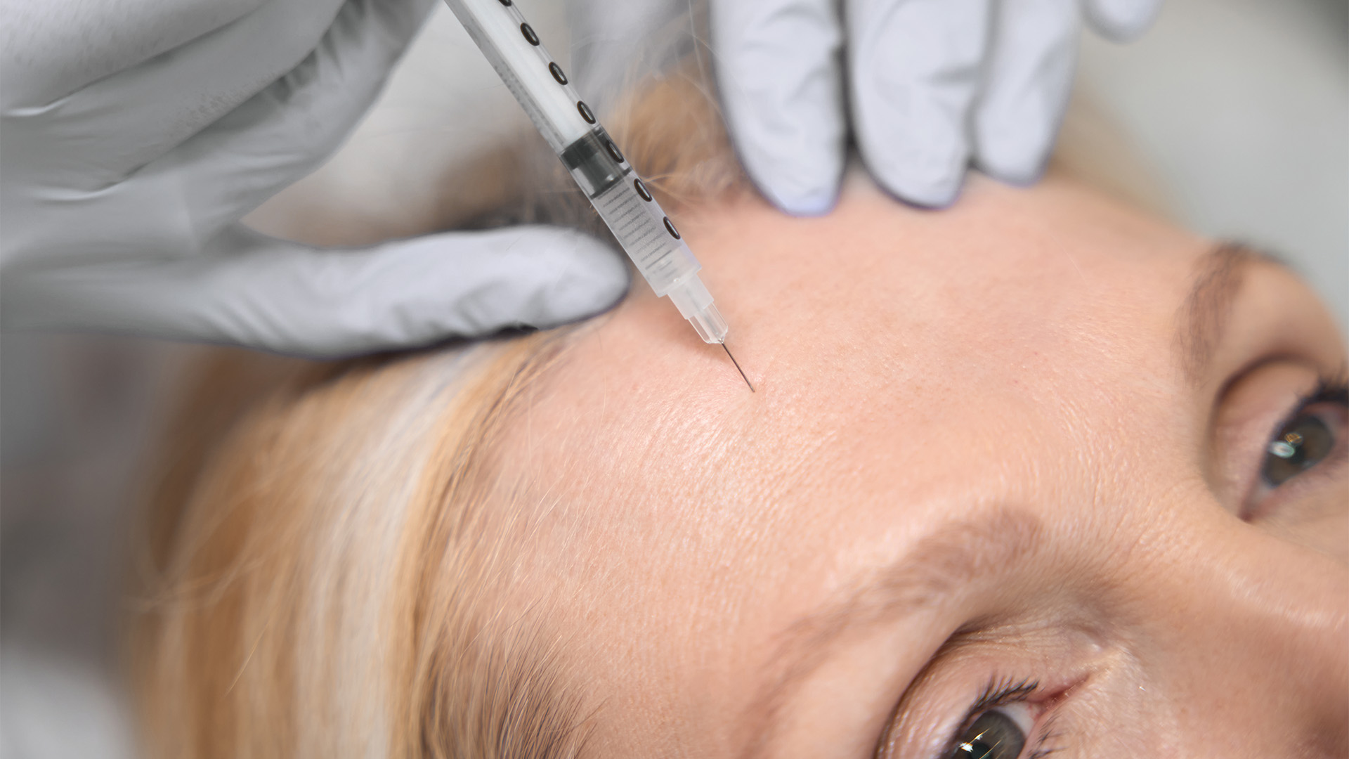 A photo of a dermapure clinic procedure room