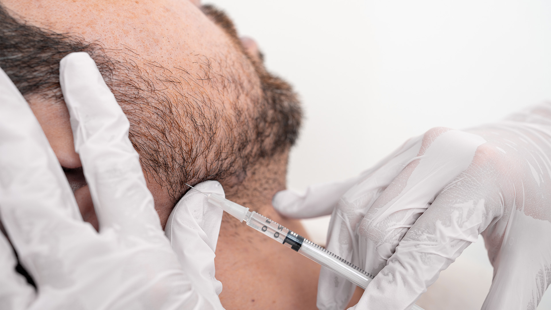A photo of a dermapure clinic procedure room