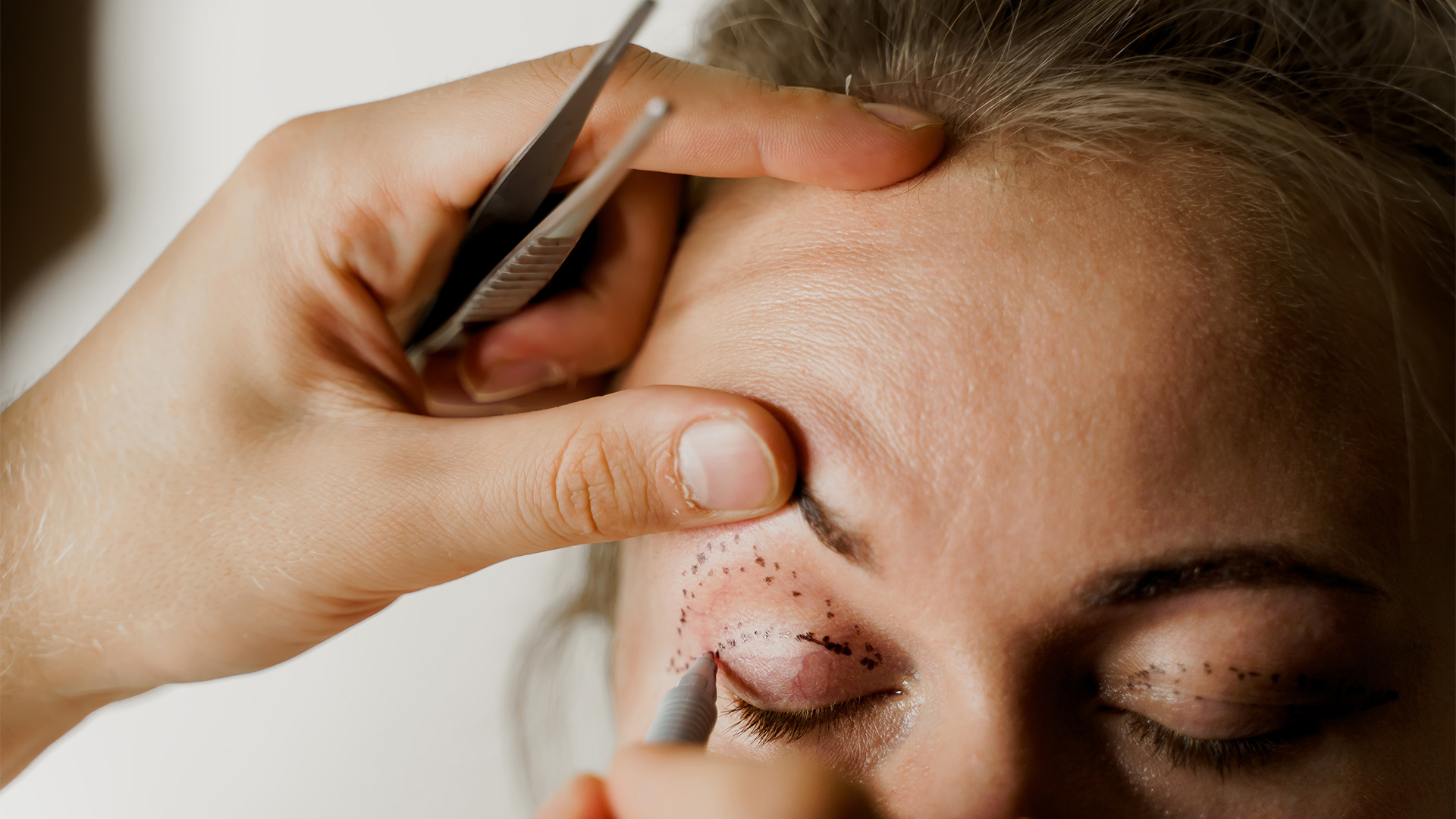 A dermapure physician treating a patient